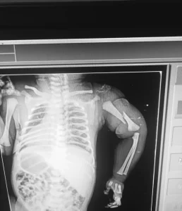 अस्पताल घटना: दतिया में नवजात के साथ शर्मनाक कृत्य