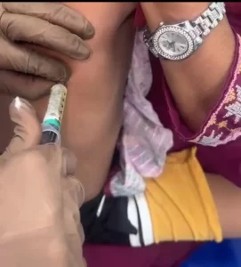 सिविल हॉस्पिटल हजीरा ग्वालियर के बाल रोग विभाग के चिकित्सकों की बड़ी सफलता:- 

( डॉ. जयेंद्र आर्य ने 8 वर्ष के बच्चे को प्ल्यूरल इफ्यूजन (Massive Pleural Effusion) का किया उपचार)